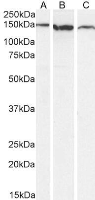 Western Blot: Goat Polyclonal EVI-1 Antibody [NBP1-68842] - (3µg/ml) staining of A431 (A), Caco-2 (B) and HeLa (C) cell lysate (35µg protein in RIPA buffer). Detected by chemiluminescence.