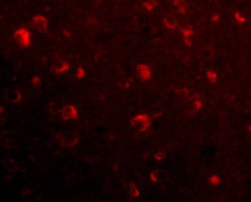 Immunocytochemistry/ Immunofluorescence: SLITRK6 Antibody - BSA Free [NBP1-76877] - Immunofluorescence of SLITRK6 in Human Brain cells with SLITRK6 antibody at 20 ug/mL.