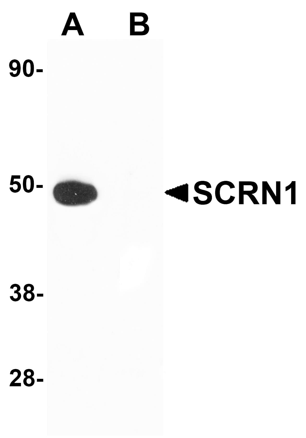 <b>Biological Strategies Validation. </b>Western Blot: Secernin-1 Antibody - BSA Free [NBP1-77187] -  Western blot analysis of SCRN1 in human kidney tissue lysate with SCRN1 antibody at 1 ug/mL in (A) the absence and (B) the presence of blocking peptide.