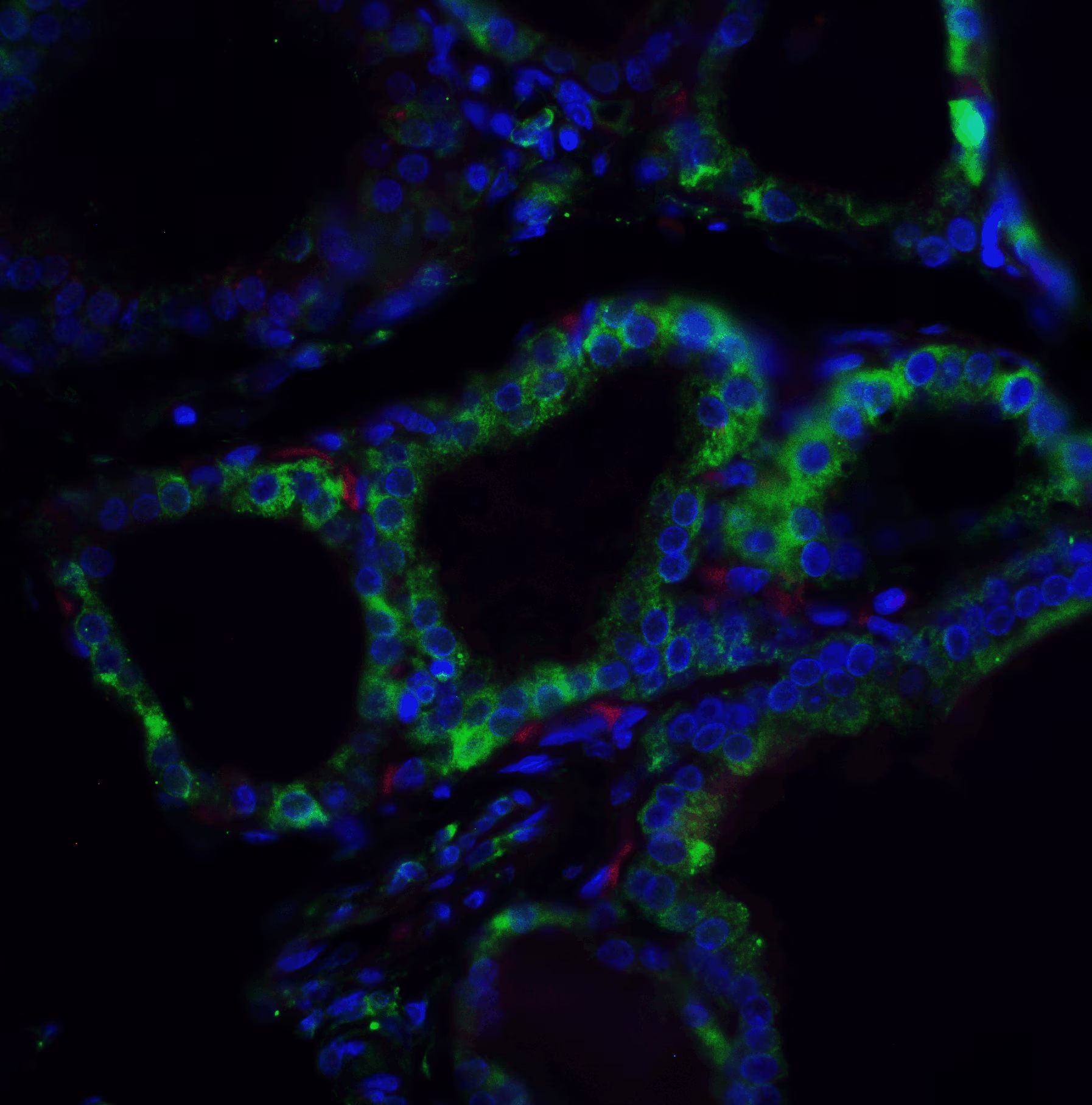 Immunocytochemistry/ Immunofluorescence: R-Spondin 1 Antibody - BSA Free [NBP1-77354] -  Validation of R-Spondin 1 in Human Spleen. Immunofluorescent analysis of 4% paraformaldehyde-fixed human spleen labeling R-Spondin 1 with at 5 ug/mL, followed by goat anti-rabbit IgG secondary antibody at 1/500 dilution (green) with Phylloidin staining (red) and DAPI staining (blue).