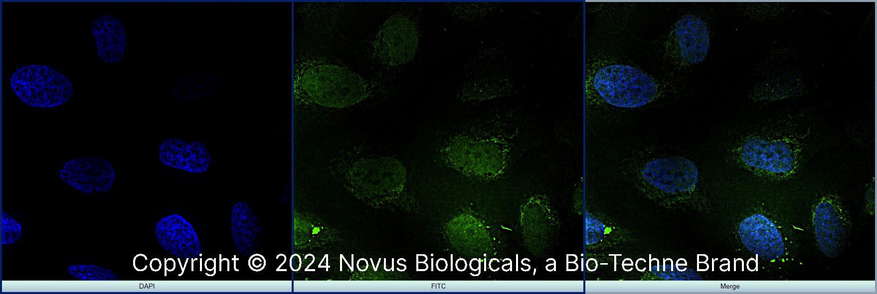 RBFOX3/NeuN was detected in immersion fixed U-2 OS human osteosarcoma cell line using Rabbit anti-RBFOX3/NeuN Antigen Affinity Purified Polyclonal Antibody conjugated to FITC (Catalog # NBP1-77686F) (green) at 10 µg/mL overnight at 4C. Cells were counterstained with DAPI (blue). Cells were imaged using a 100X objective and digitally deconvolved. 