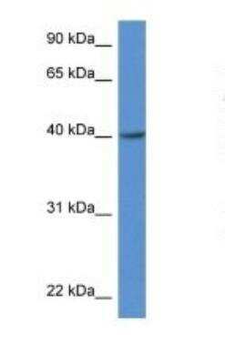 ZDHHC11 Antibody Titration: 1.0 ug/ml Positive Control: Rat Muscle.