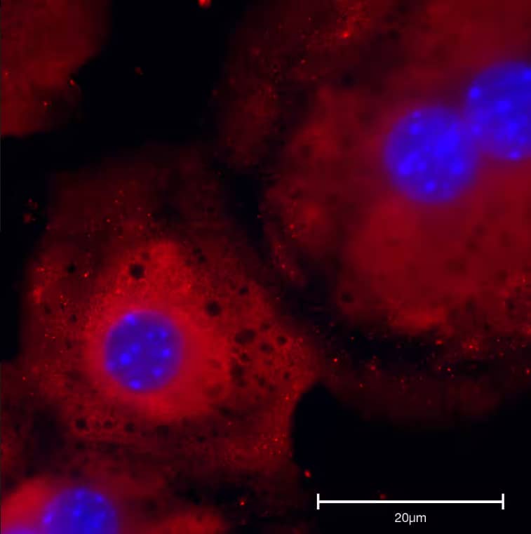 Immunocytochemistry/Immunofluorescence: Rabbit Polyclonal TGF-beta 1 Antibody [NBP1-80289] - Mice hepatocytes stained with TGF-beta 1 Antibody. Image from a verified customer review.