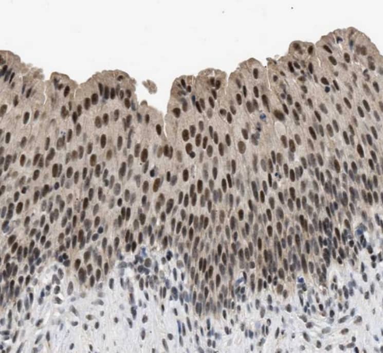  Staining of human Urinary bladder shows moderate nuclear positivity in urothelial cells.