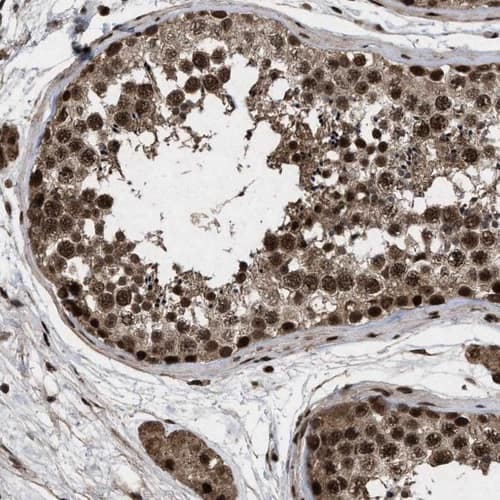 The staining of human testis shows strong nuclear-cytoplasmic positivity in cells in seminiferous ducts.