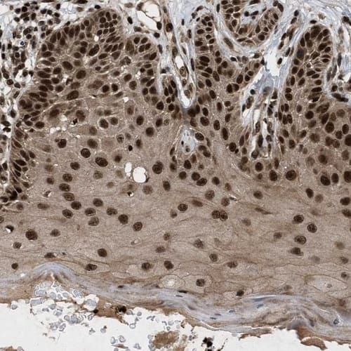 Staining of human skin shows strong nuclear-cytoplasmic positivity in squamous epithelial cells.