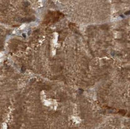 Immunohistochemistry-Paraffin ZFAND5 Antibody