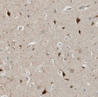 Immunohistochemistry-Paraffin ZFAND5 Antibody