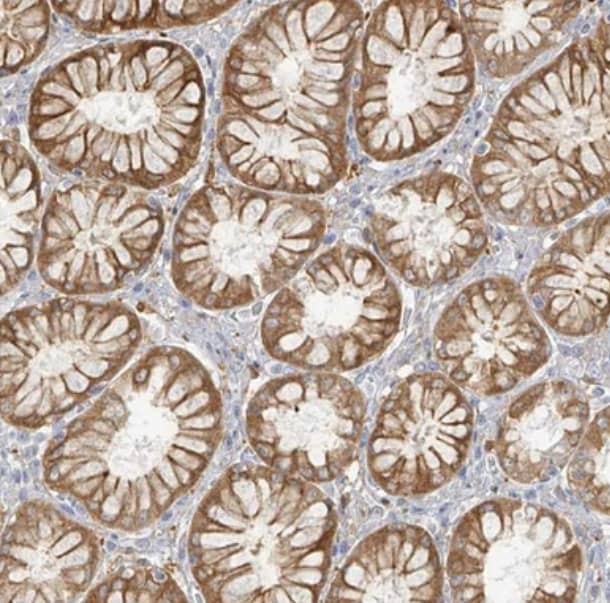 Immunohistochemistry-Paraffin Uroplakin Ib Antibody - BSA Free