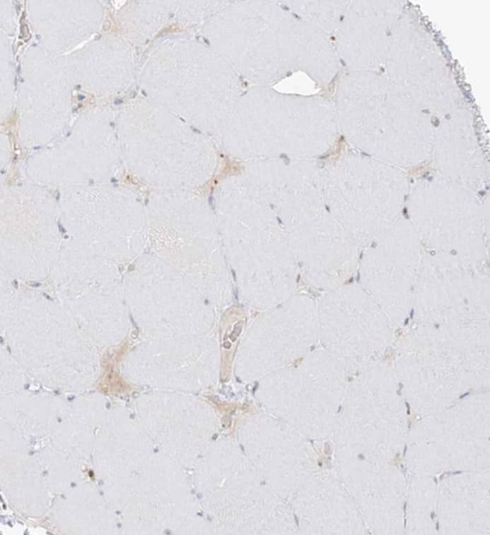 Immunohistochemistry-Paraffin Uroplakin Ib Antibody - BSA Free
