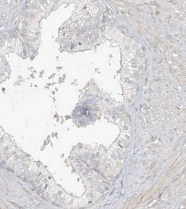 Immunohistochemistry-Paraffin Uroplakin Ib Antibody - BSA Free