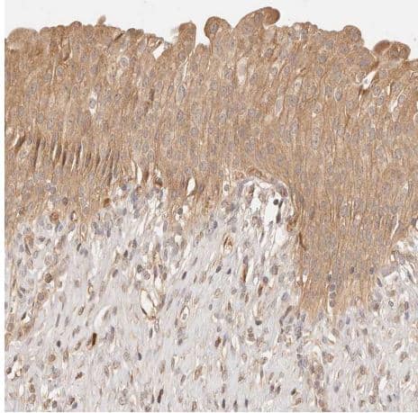 Immunohistochemistry-Paraffin: PHLDA3 Antibody [NBP1-80683] -Staining of human urinary bladder shows moderate cytoplasmic positivity in urothelial cells.