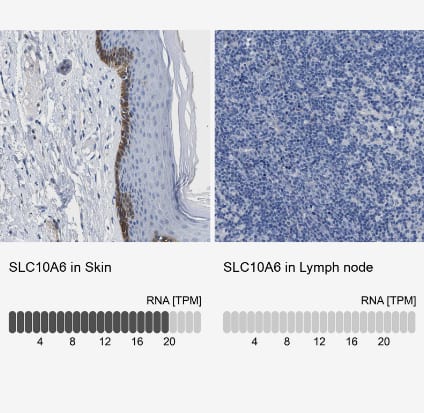 Immunohistochemistry-Paraffin SLC10A6 Antibody