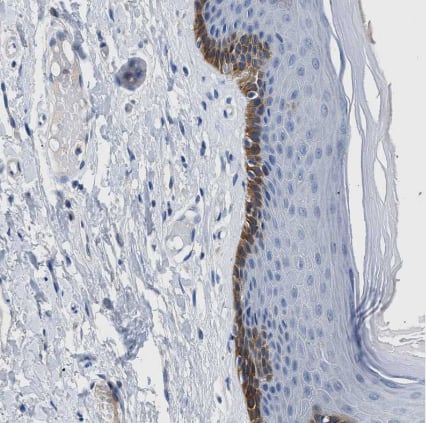 Immunohistochemistry-Paraffin SLC10A6 Antibody