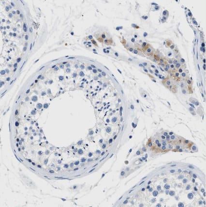 Immunohistochemistry-Paraffin: SLC10A6 Antibody [NBP1-80734] -Staining of human testis shows weak cytoplasmic positivity in Leydig cells.