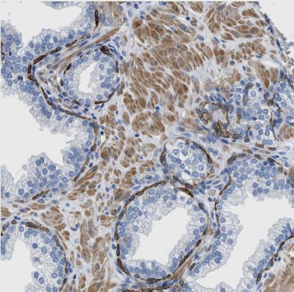 Immunohistochemistry-Paraffin: SLC10A6 Antibody [NBP1-80734] -Staining of human prostate shows strong cytoplasmic positivity in glandular cells.