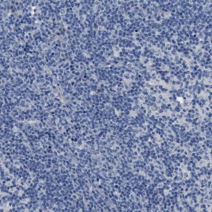 Immunohistochemistry-Paraffin SLC10A6 Antibody