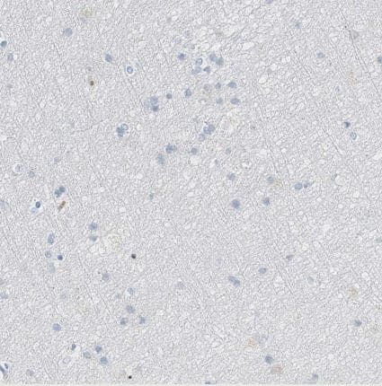 Immunohistochemistry-Paraffin Serine protease 23 Antibody - BSA Free