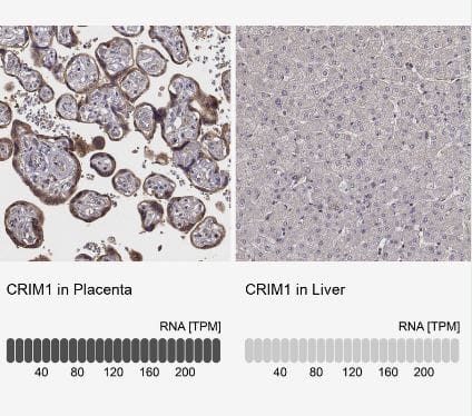 Immunohistochemistry-Paraffin CRIM1 Antibody