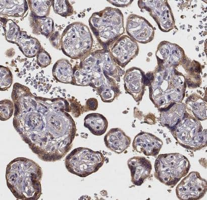 Immunohistochemistry-Paraffin CRIM1 Antibody