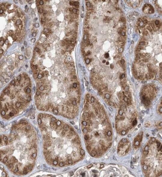 Immunohistochemistry-Paraffin RBJ Antibody - BSA Free