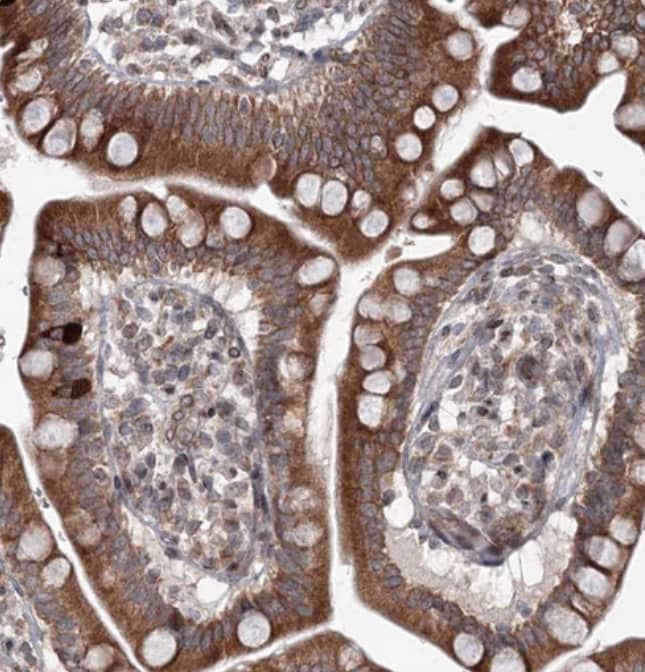  Staining of human small intestine shows strong cytoplasmic positivity in glandular cells.