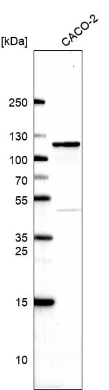 Analysis in human cell line CACO-2.