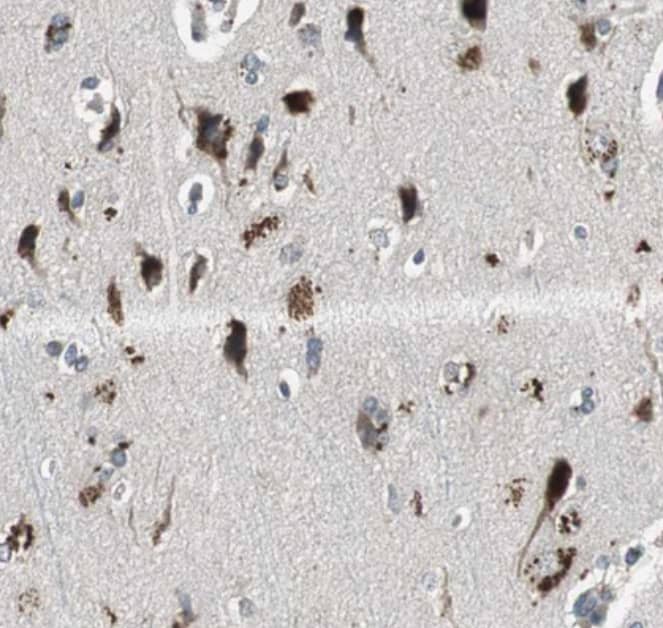 Immunohistochemistry-Paraffin PI4KB/PI4KIII beta Antibody - BSA Free