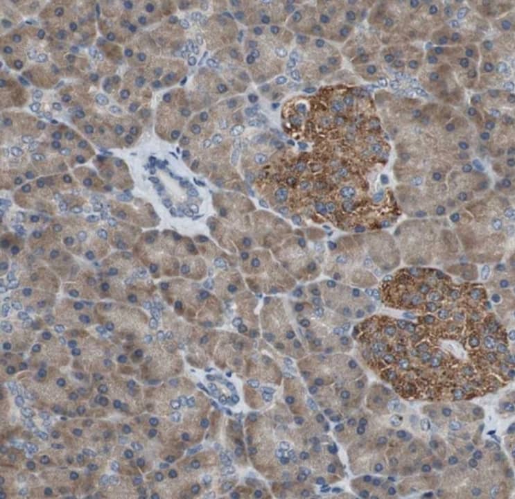 Immunohistochemistry-Paraffin PI4KB/PI4KIII beta Antibody - BSA Free
