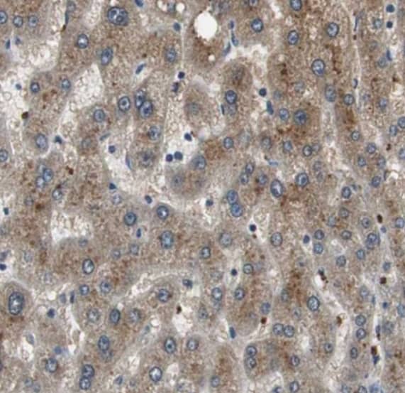 Immunohistochemistry-Paraffin PI4KB/PI4KIII beta Antibody - BSA Free