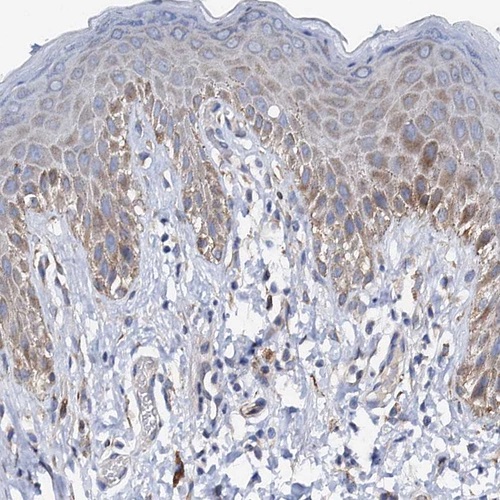 Immunohistochemistry-Paraffin PAMCI Antibody - BSA Free