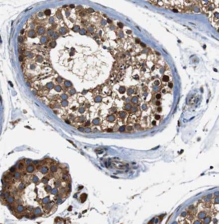 Staining of human testis shows moderate cytoplasmic positivity in cells in seminiferous ducts and Leydig cells.