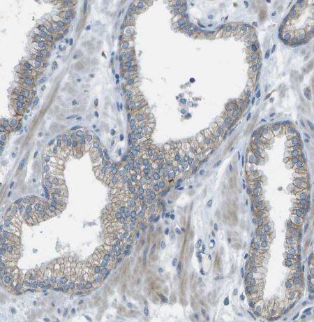 Immunohistochemistry-Paraffin: KCTD3 Antibody [NBP1-80981] - Staining of human prostate shows weak membranous positivity in glandular cells.