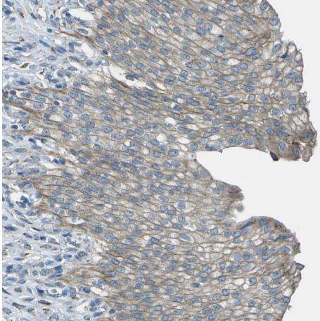 Immunohistochemistry-Paraffin: KCTD3 Antibody [NBP1-80981] - Staining of human urinary bladder shows weak membranous positivity in urothelial cells.