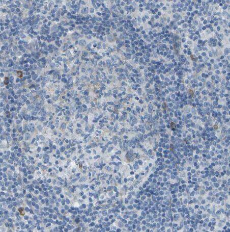 Immunohistochemistry-Paraffin: KCTD3 Antibody [NBP1-80981] - Staining of human lymph node shows no positivity in germinal center cells as expected.