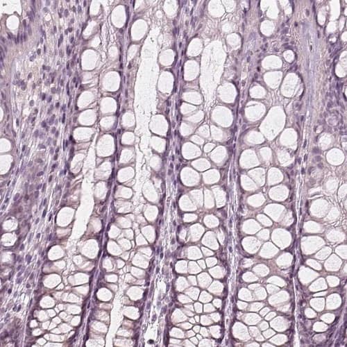 Staining of human colon shows no positivity in glandular cells as expected.