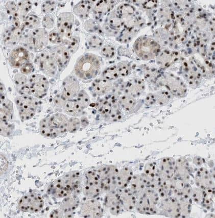 Immunohistochemistry-Paraffin HEMK1 Antibody