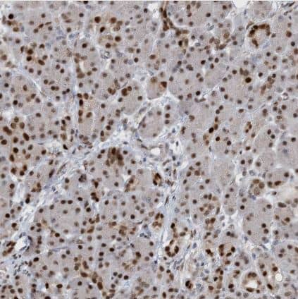 Immunohistochemistry-Paraffin HEMK1 Antibody