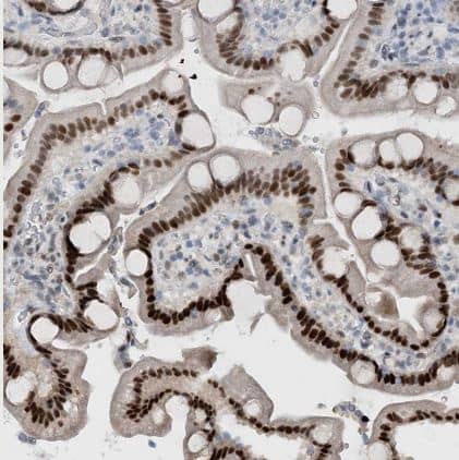 Immunohistochemistry-Paraffin HEMK1 Antibody