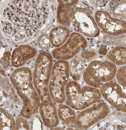 Immunohistochemistry-Paraffin RABIF/MSS4 Antibody - BSA Free