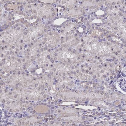 Immunohistochemistry-Paraffin CMSS1 Antibody - BSA Free