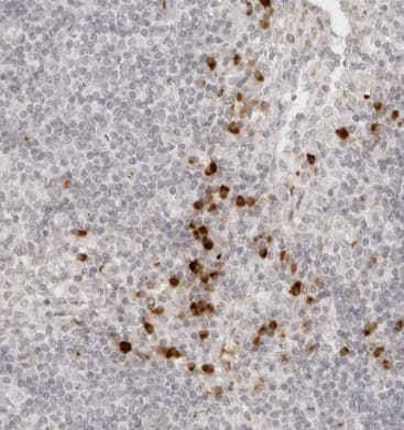 Staining of human lymph node shows strong cytoplasmic positivity in subset of non-germinal center cells.