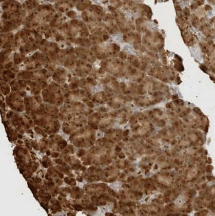 Staining of human pancreas shows strong granular cytoplasmic positivity in exocrine glandular cells.