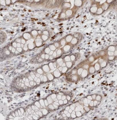 Staining of human rectum shows strong cytoplasmic positivity in subset of lymphoid cells.