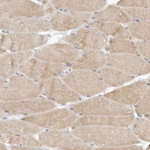 Immunohistochemistry-Paraffin TSEN2 Antibody - BSA Free