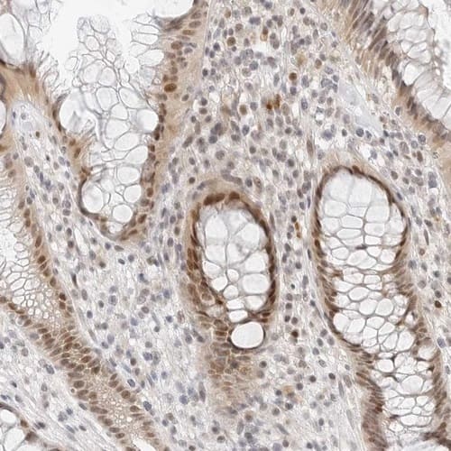Immunohistochemistry-Paraffin TSEN2 Antibody - BSA Free