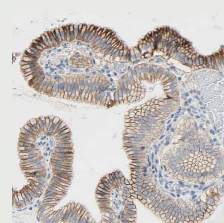 Immunohistochemistry-Paraffin: TMIGD2 Antibody [NBP1-81164] -Staining of human gallbladder shows strong membranous positivity in glandular cells.