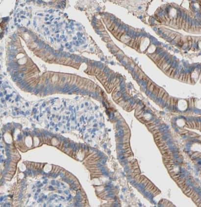 Immunohistochemistry-Paraffin: TMIGD2 Antibody [NBP1-81164] -Staining of human duodenum shows strong membranous positivity in glandular cells.