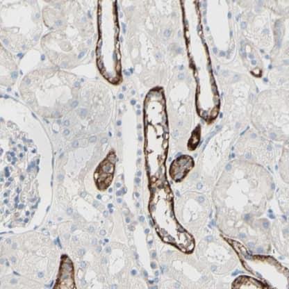 Immunohistochemistry-Paraffin: TMIGD2 Antibody [NBP1-81164] -Staining of human kidney shows strong membranous positivity in cells in distal tubules.