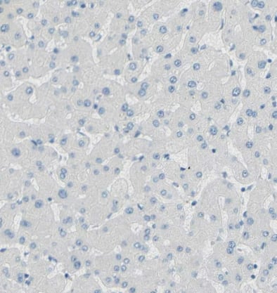 Immunohistochemistry-Paraffin: TMIGD2 Antibody [NBP1-81164] -Staining of human liver shows no positivity in hepatocytes as expected.